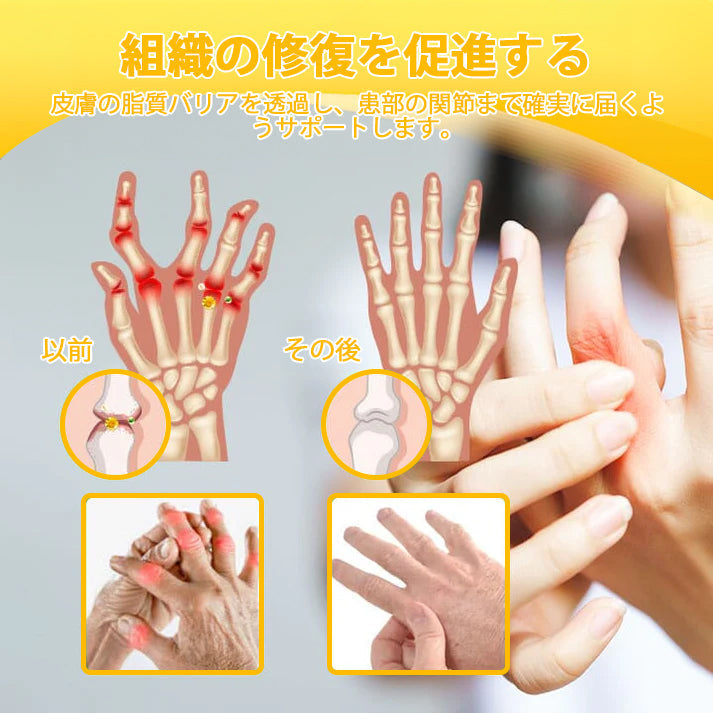 🎁BSWELL® ハチ毒エキス配合 関節ケアクリーム｜関節サポート・膝・腰・肩の違和感ケア｜ニュージーランド産原料使用 高機能リペアクリーム